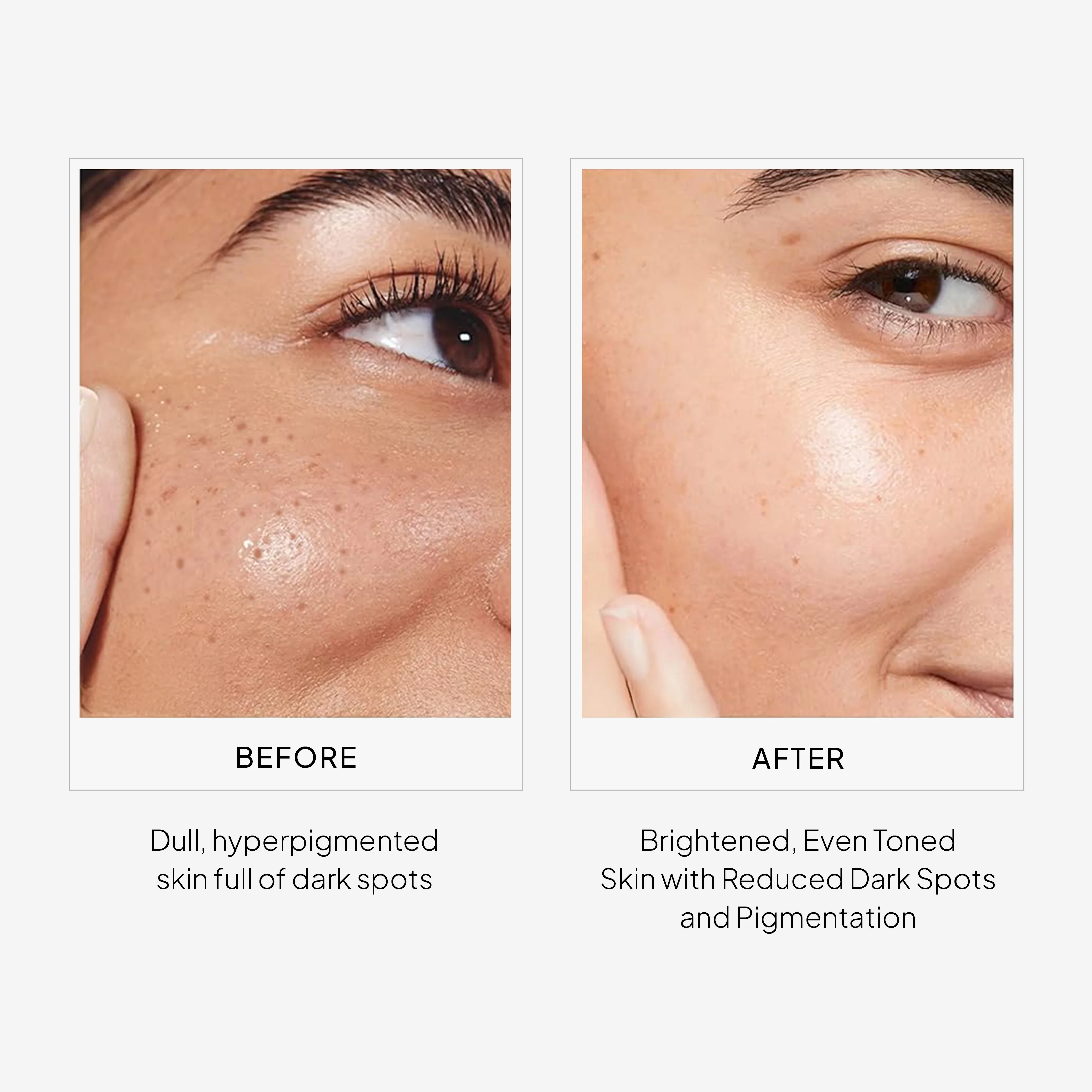 EpiLight Night Serum - Image 5